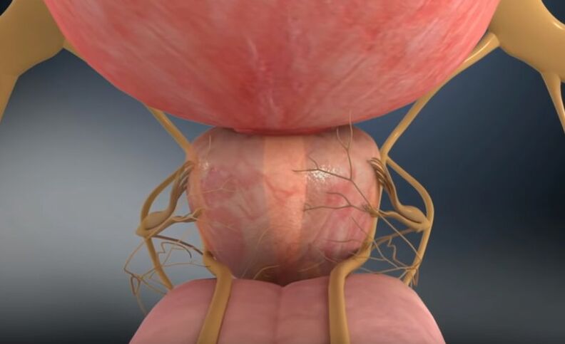 Prostata