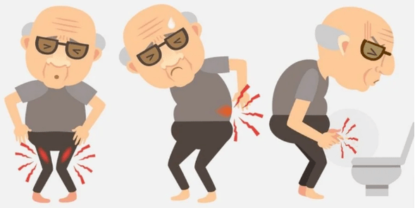 Symptome einer Prostatitis