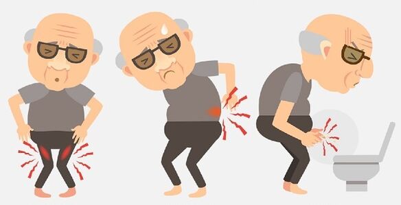 Symptome einer Prostatitis und ihre Behandlung mit Medikamenten